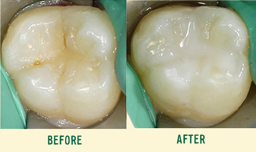 before after before after